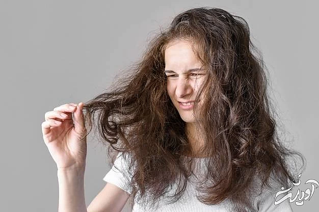 از بین بردن چسبندگی آدامس از مو چسبندگی مو